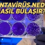 Gemide tespit edilen Hantavirüs nedir, nasıl bulaşır? Hantavirüs belirtileri nelerdir?