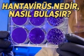 Gemide tespit edilen Hantavirüs nedir, nasıl bulaşır? Hantavirüs belirtileri nelerdir?