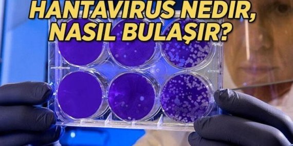 HANTAVİRÜS NASIL BULAŞIR, NASIL YAYILIR? Hantavirüs insandan insana bulaşır mı, belirtileri nelerdir?