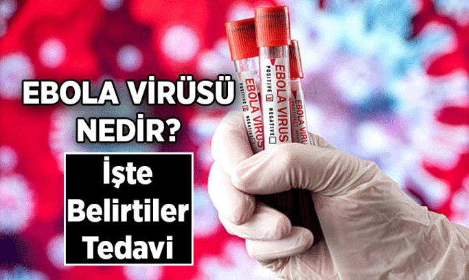Ebola salgını nedir, nerede var? Ebola virüsü belirtileri nelerdir, bulaşıcı mı, nasıl bulaşır?